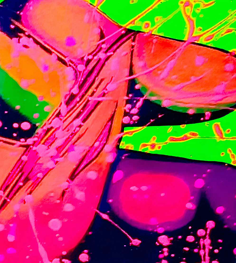 “Lainier’s Finger” Fairy Tale Series